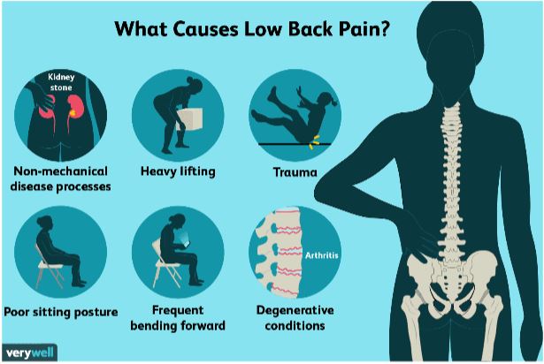 What Causes Lower Back Pain? - Strive! Physical Therapy Centers