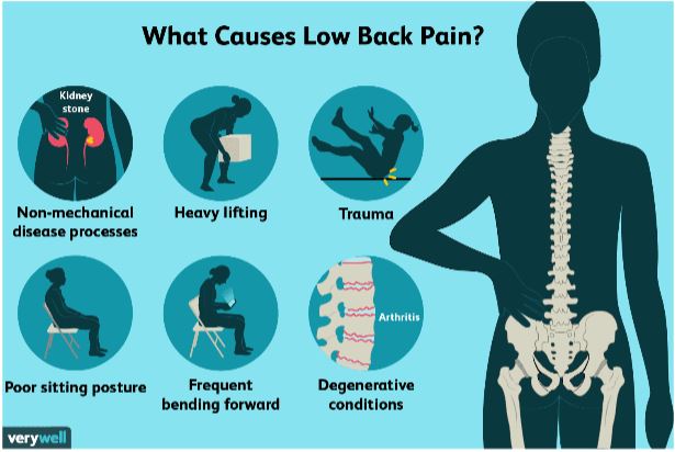 Lower Back Pain One Side Down Leg