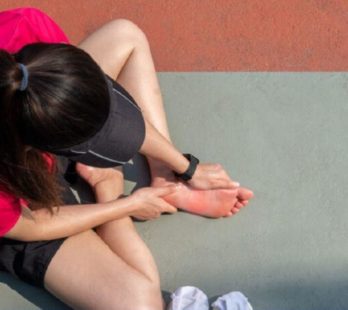 Plantar Fasciitis